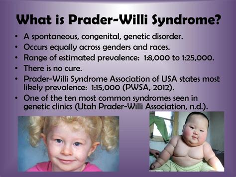 laurens vlasveld prada willi syndroom|prader willi syndrome diagnosis.